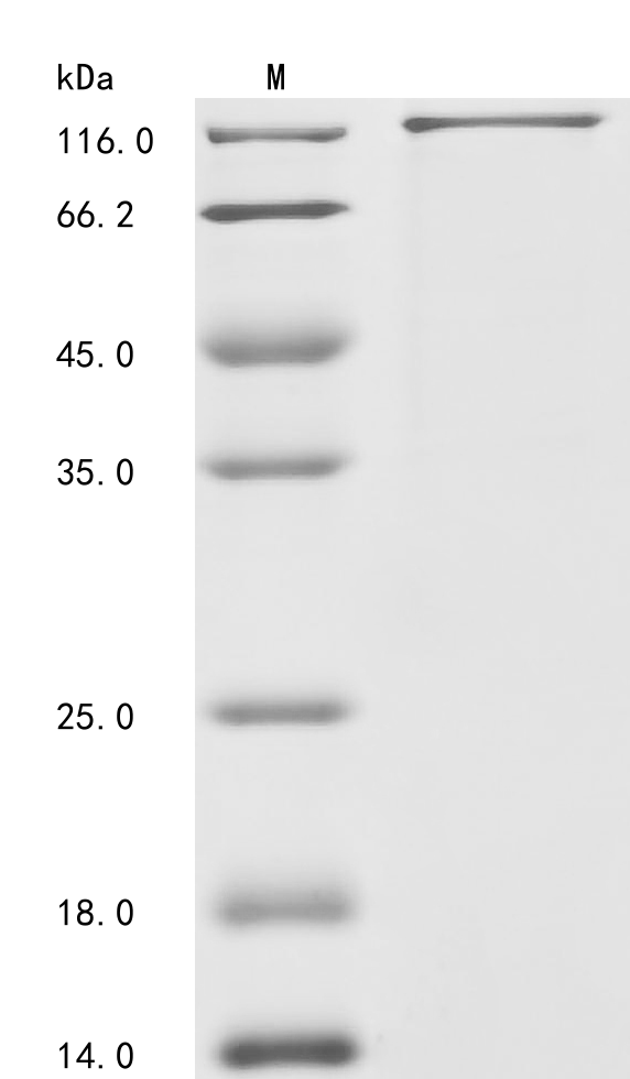 (Tris-Glycine gel) Discontinuous SDS-PAGE (reduced) with 5% enrichment gel and 15% separation gel. (Tris-Glycine gel) Discontinuous SDS-PAGE (reduced) with 5% enrichment gel and 15% separation gel.