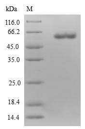 (Tris-Glycine gel) Discontinuous SDS-PAGE (reduced) with 5% enrichment gel and 15% separation gel. (Tris-Glycine gel) Discontinuous SDS-PAGE (reduced) with 5% enrichment gel and 15% separation gel.