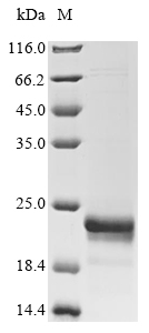 Recombinant Human Fatty acid-binding protein (FABP5) - image 1