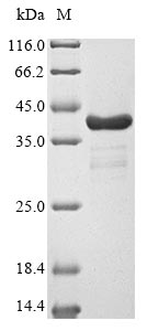 (Tris-Glycine gel) Discontinuous SDS-PAGE (reduced) with 5% enrichment gel and 15% separation gel. (Tris-Glycine gel) Discontinuous SDS-PAGE (reduced) with 5% enrichment gel and 15% separation gel.