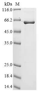 Recombinant Human Extended synaptotagmin-2 (ESYT2) , partial - image 1