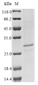 (Tris-Glycine gel) Discontinuous SDS-PAGE (reduced) with 5% enrichment gel and 15% separation gel. (Tris-Glycine gel) Discontinuous SDS-PAGE (reduced) with 5% enrichment gel and 15% separation gel.