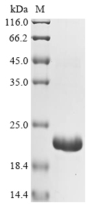 Recombinant Bovine Fibrillin-1 (FBN1) , partial - image 1