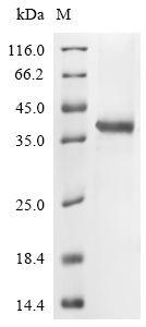 (Tris-Glycine gel) Discontinuous SDS-PAGE (reduced) with 5% enrichment gel and 15% separation gel. (Tris-Glycine gel) Discontinuous SDS-PAGE (reduced) with 5% enrichment gel and 15% separation gel.