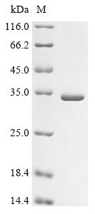 (Tris-Glycine gel) Discontinuous SDS-PAGE (reduced) with 5% enrichment gel and 15% separation gel. (Tris-Glycine gel) Discontinuous SDS-PAGE (reduced) with 5% enrichment gel and 15% separation gel.