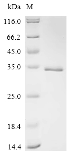 Recombinant Sheep Fibroblast growth factor 2 (FGF2) - image 1