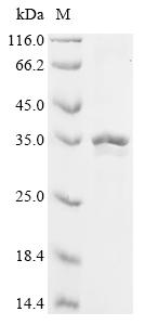 Recombinant Human Fibroblast growth factor 3 (FGF3) - image 1