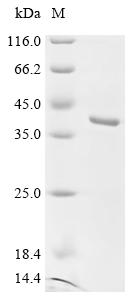Recombinant Human Fibroblast growth factor 5 (FGF5) - image 1