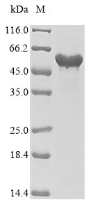 (Tris-Glycine gel) Discontinuous SDS-PAGE (reduced) with 5% enrichment gel and 15% separation gel. (Tris-Glycine gel) Discontinuous SDS-PAGE (reduced) with 5% enrichment gel and 15% separation gel.