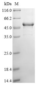 (Tris-Glycine gel) Discontinuous SDS-PAGE (reduced) with 5% enrichment gel and 15% separation gel. (Tris-Glycine gel) Discontinuous SDS-PAGE (reduced) with 5% enrichment gel and 15% separation gel.