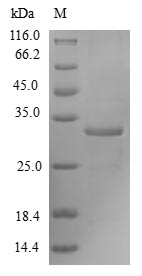 SDS-PAGE- Recombinant protein Human FOxM1