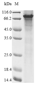 Recombinant Human Forkhead box protein N1 (FOXN1) - image 1