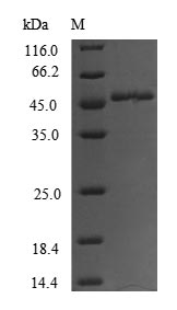 (Tris-Glycine gel) Discontinuous SDS-PAGE (reduced) with 5% enrichment gel and 15% separation gel. (Tris-Glycine gel) Discontinuous SDS-PAGE (reduced) with 5% enrichment gel and 15% separation gel.