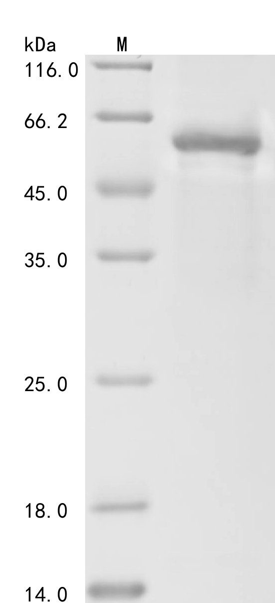 (Tris-Glycine gel) Discontinuous SDS-PAGE (reduced) with 5% enrichment gel and 15% separation gel. (Tris-Glycine gel) Discontinuous SDS-PAGE (reduced) with 5% enrichment gel and 15% separation gel.