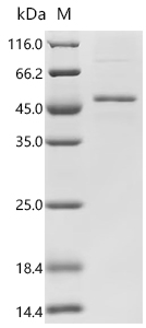 Recombinant Human Follicle-stimulating hormone receptor (FSHR) , partial - image 1