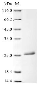 Recombinant Human Ferritin light chain (FTL) - image 1