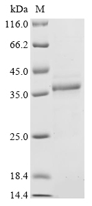 (Tris-Glycine gel) Discontinuous SDS-PAGE (reduced) with 5% enrichment gel and 15% separation gel. (Tris-Glycine gel) Discontinuous SDS-PAGE (reduced) with 5% enrichment gel and 15% separation gel.