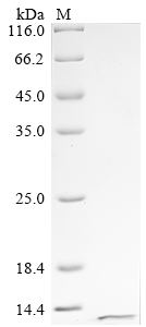 (Tris-Glycine gel) Discontinuous SDS-PAGE (reduced) with 5% enrichment gel and 15% separation gel. (Tris-Glycine gel) Discontinuous SDS-PAGE (reduced) with 5% enrichment gel and 15% separation gel.
