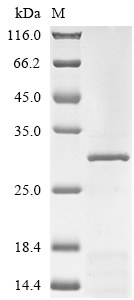(Tris-Glycine gel) Discontinuous SDS-PAGE (reduced) with 5% enrichment gel and 15% separation gel. (Tris-Glycine gel) Discontinuous SDS-PAGE (reduced) with 5% enrichment gel and 15% separation gel.