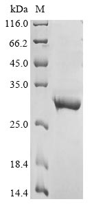 (Tris-Glycine gel) Discontinuous SDS-PAGE (reduced) with 5% enrichment gel and 15% separation gel. (Tris-Glycine gel) Discontinuous SDS-PAGE (reduced) with 5% enrichment gel and 15% separation gel.
