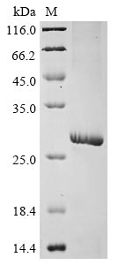 (Tris-Glycine gel) Discontinuous SDS-PAGE (reduced) with 5% enrichment gel and 15% separation gel. (Tris-Glycine gel) Discontinuous SDS-PAGE (reduced) with 5% enrichment gel and 15% separation gel.