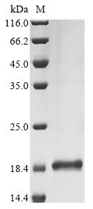 (Tris-Glycine gel) Discontinuous SDS-PAGE (reduced) with 5% enrichment gel and 15% separation gel. (Tris-Glycine gel) Discontinuous SDS-PAGE (reduced) with 5% enrichment gel and 15% separation gel.