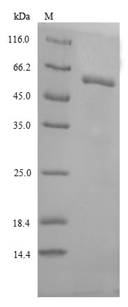 SDS-PAGE- Recombinant protein Human GBA