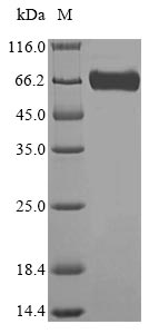 SDS-PAGE- Recombinant protein Mouse Gba