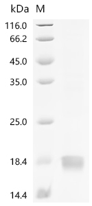 Recombinant Human Growth/differentiation factor 9 (GDF9) - image 1