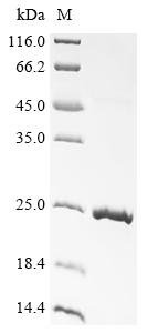 Recombinant Sheep Growth/differentiation factor 9 (GDF9) - image 1
