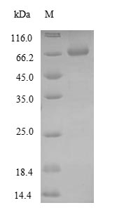 (Tris-Glycine gel) Discontinuous SDS-PAGE (reduced) with 5% enrichment gel and 15% separation gel. (Tris-Glycine gel) Discontinuous SDS-PAGE (reduced) with 5% enrichment gel and 15% separation gel.