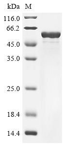 (Tris-Glycine gel) Discontinuous SDS-PAGE (reduced) with 5% enrichment gel and 15% separation gel. (Tris-Glycine gel) Discontinuous SDS-PAGE (reduced) with 5% enrichment gel and 15% separation gel.
