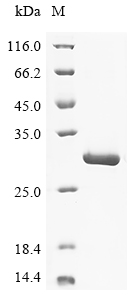 Recombinant Macaca mulatta Somatotropin (GH1) - image 1