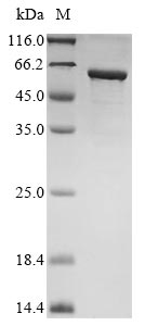 (Tris-Glycine gel) Discontinuous SDS-PAGE (reduced) with 5% enrichment gel and 15% separation gel. (Tris-Glycine gel) Discontinuous SDS-PAGE (reduced) with 5% enrichment gel and 15% separation gel.