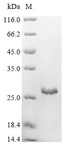 (Tris-Glycine gel) Discontinuous SDS-PAGE (reduced) with 5% enrichment gel and 15% separation gel. (Tris-Glycine gel) Discontinuous SDS-PAGE (reduced) with 5% enrichment gel and 15% separation gel.