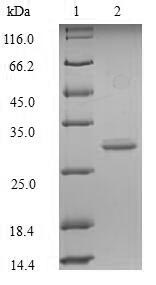 SDS-PAGE- Recombinant protein Mouse Glp1r