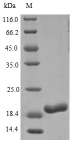 (Tris-Glycine gel) Discontinuous SDS-PAGE (reduced) with 5% enrichment gel and 15% separation gel. (Tris-Glycine gel) Discontinuous SDS-PAGE (reduced) with 5% enrichment gel and 15% separation gel.