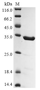 Recombinant Human Gelsolin (GSN) , partial - image 1