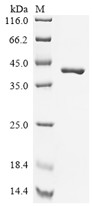 (Tris-Glycine gel) Discontinuous SDS-PAGE (reduced) with 5% enrichment gel and 15% separation gel.