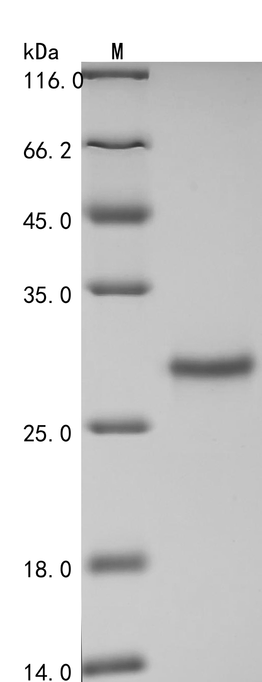 (Tris-Glycine gel) Discontinuous SDS-PAGE (reduced) with 5% enrichment gel and 15% separation gel.