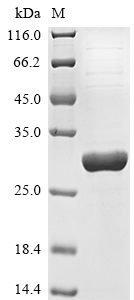 (Tris-Glycine gel) Discontinuous SDS-PAGE (reduced) with 5% enrichment gel and 15% separation gel.