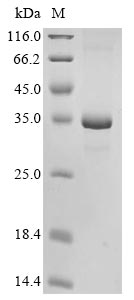 (Tris-Glycine gel) Discontinuous SDS-PAGE (reduced) with 5% enrichment gel and 15% separation gel. (Tris-Glycine gel) Discontinuous SDS-PAGE (reduced) with 5% enrichment gel and 15% separation gel.
