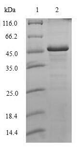(Tris-Glycine gel) Discontinuous SDS-PAGE (reduced) with 5% enrichment gel and 15% separation gel. (Tris-Glycine gel) Discontinuous SDS-PAGE (reduced) with 5% enrichment gel and 15% separation gel.
