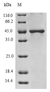(Tris-Glycine gel) Discontinuous SDS-PAGE (reduced) with 5% enrichment gel and 15% separation gel. (Tris-Glycine gel) Discontinuous SDS-PAGE (reduced) with 5% enrichment gel and 15% separation gel.