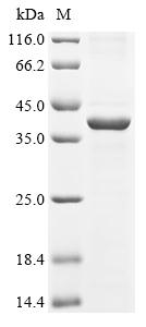 Recombinant Human Hyaluronan and proteoglycan link protein 1 (HAPLN1) - image 1