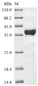 Recombinant Human Hyaluronan and proteoglycan link protein 2 (HAPLN2) - image 1