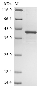 (Tris-Glycine gel) Discontinuous SDS-PAGE (reduced) with 5% enrichment gel and 15% separation gel. (Tris-Glycine gel) Discontinuous SDS-PAGE (reduced) with 5% enrichment gel and 15% separation gel.