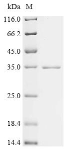 Recombinant Mouse Hemoglobin subunit alpha (Hba) - image 1