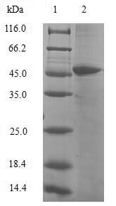 (Tris-Glycine gel) Discontinuous SDS-PAGE (reduced) with 5% enrichment gel and 15% separation gel. (Tris-Glycine gel) Discontinuous SDS-PAGE (reduced) with 5% enrichment gel and 15% separation gel.