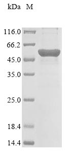 (Tris-Glycine gel) Discontinuous SDS-PAGE (reduced) with 5% enrichment gel and 15% separation gel. (Tris-Glycine gel) Discontinuous SDS-PAGE (reduced) with 5% enrichment gel and 15% separation gel.